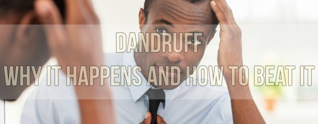 Dandruff Why It Happens and How To Beat It